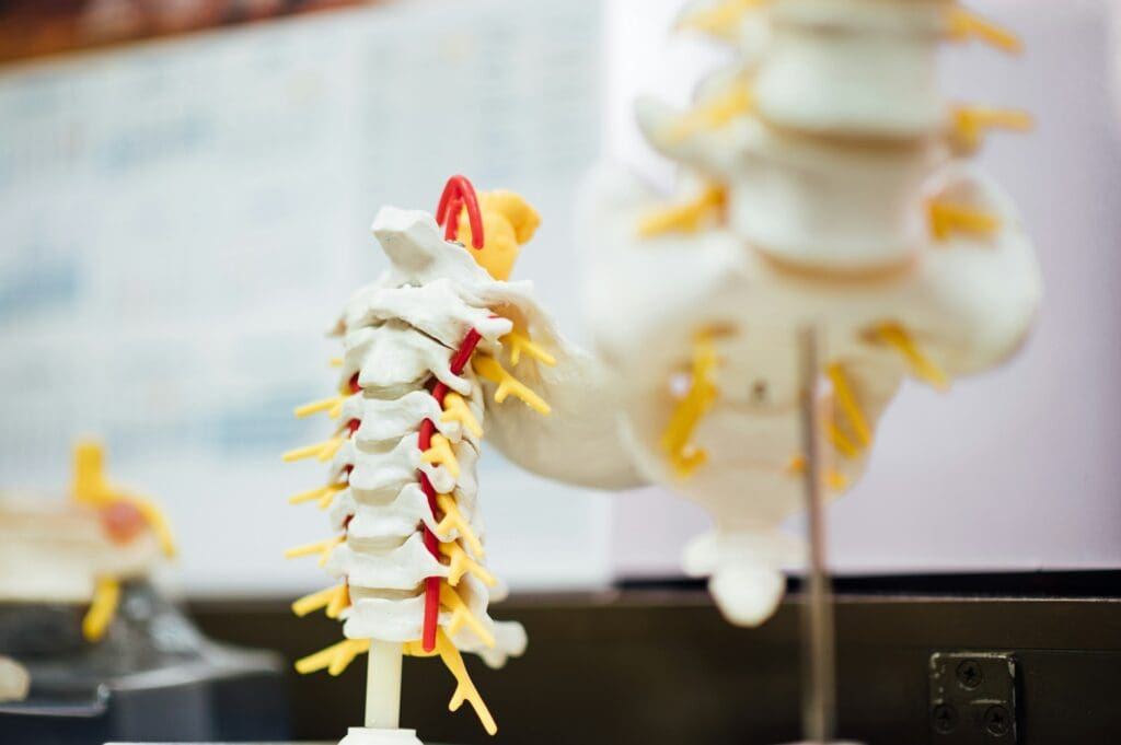 Spine model showing how a bulging disc can place pressure on nearby nerves
